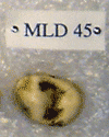 MLD 45